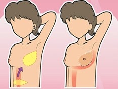 Public Photos / Files - Surgery Fig4