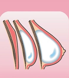 Public Photos / Files - Surgery Fig2